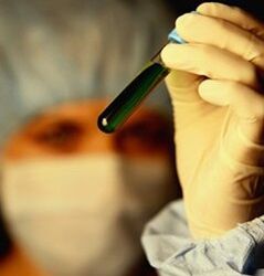 jak se nechat otestovat na parazity