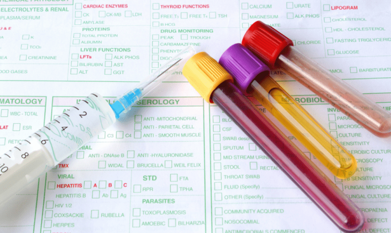 možnosti diagnostiky parazitů v těle