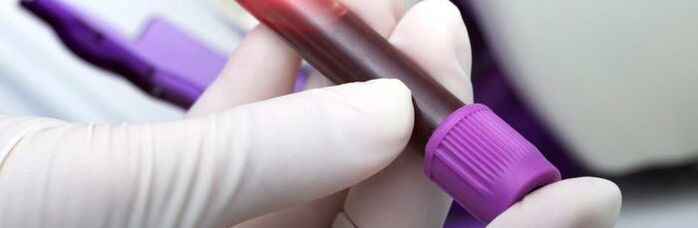 krev pro testování na parazity