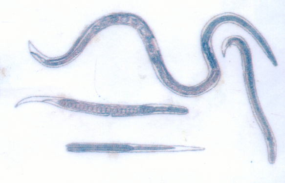Guinejský červ, který parazituje pod kůží, se snadno nakazí