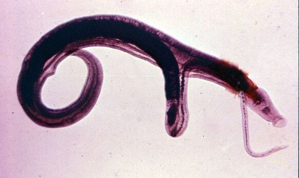 Schistosomy jsou jedním z nejběžnějších a nejnebezpečnějších parazitů